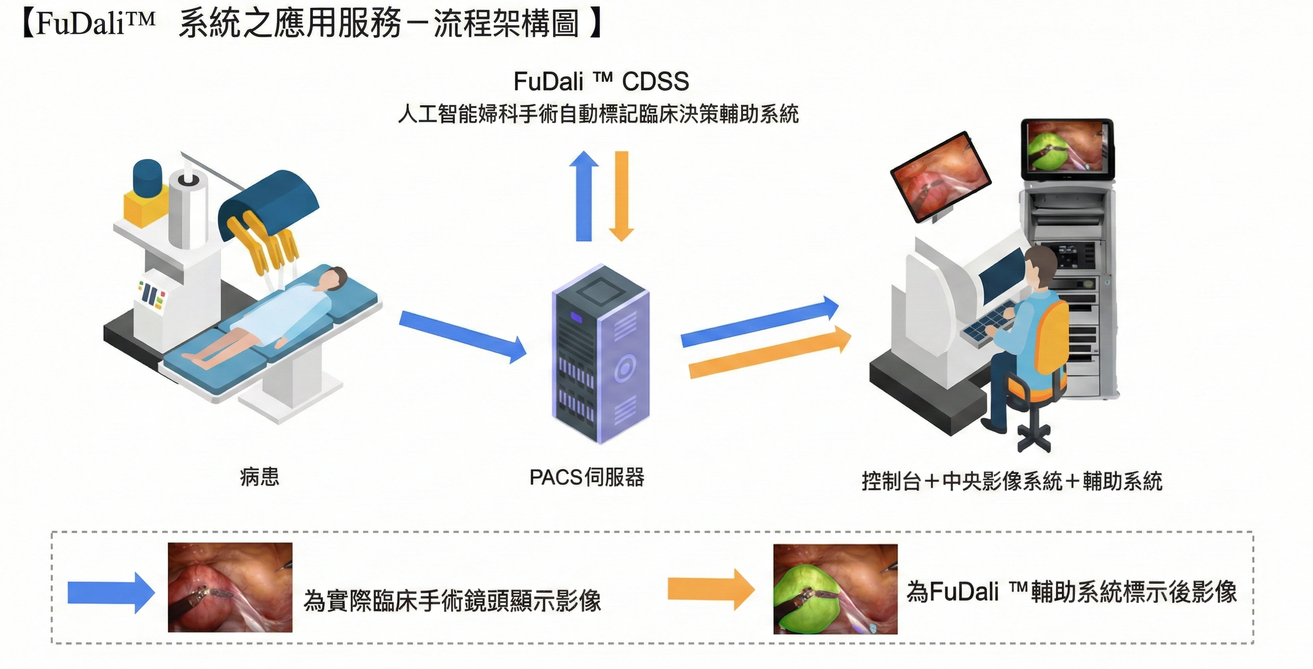 研究團隊計畫透過合作廠商將人工智能婦科手術自動標記臨床決策輔助系統整合至達文西手術使用之PACS伺服器，藉由雙螢幕或分割畫面同步顯示手術即時影像與AI器官標記結果，提升醫師判讀效率與準確度。